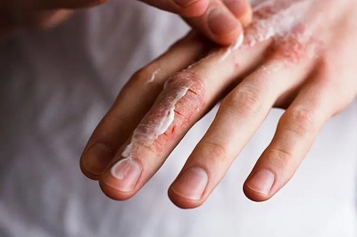 Sodium heparin: what is it? how does it work?