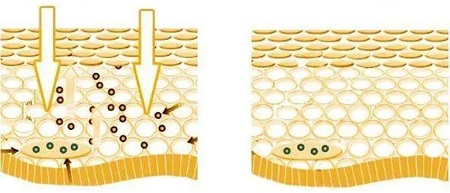 tranexamic acid benefits - ZHENYIBIO