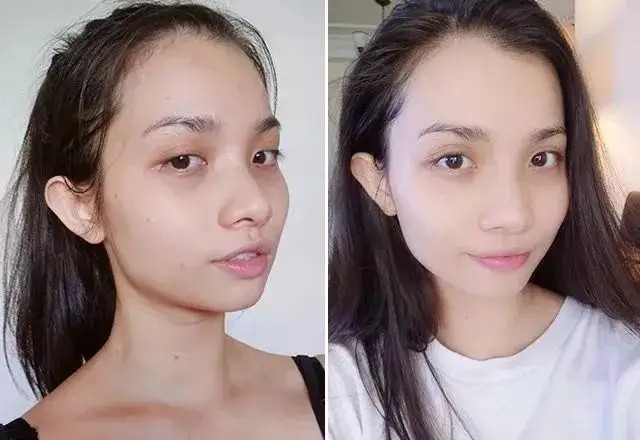 What are the benefits of alpha arbutin