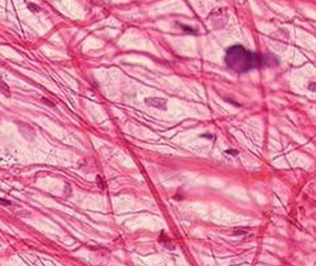 What is Acetyl Tetrapeptide?