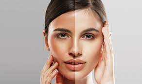 What Is Arbutin? Skin-Care Benefits, Side Effects, How to Use It
